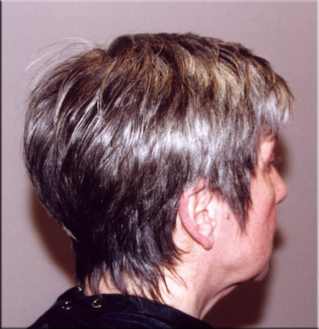 Pixie cut hairline.